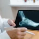 Consulta médica por nervio dolor talon lateral interno en el talón interno del pie con una evaluación clínica del dolor al caminar.